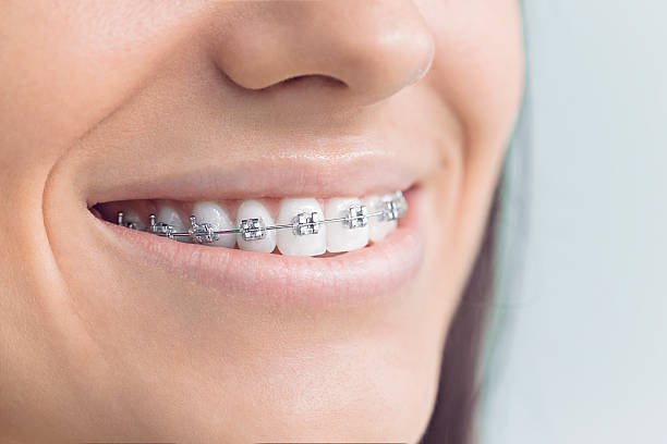 Best Teeth Whitening  in Monroeville, OH